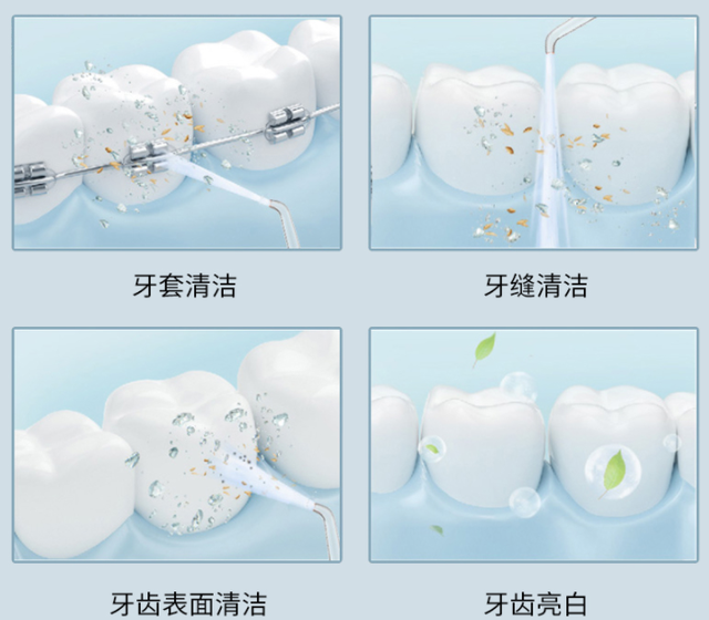 冲牙器十大品牌排行榜，万人收藏的实用干货！插图22