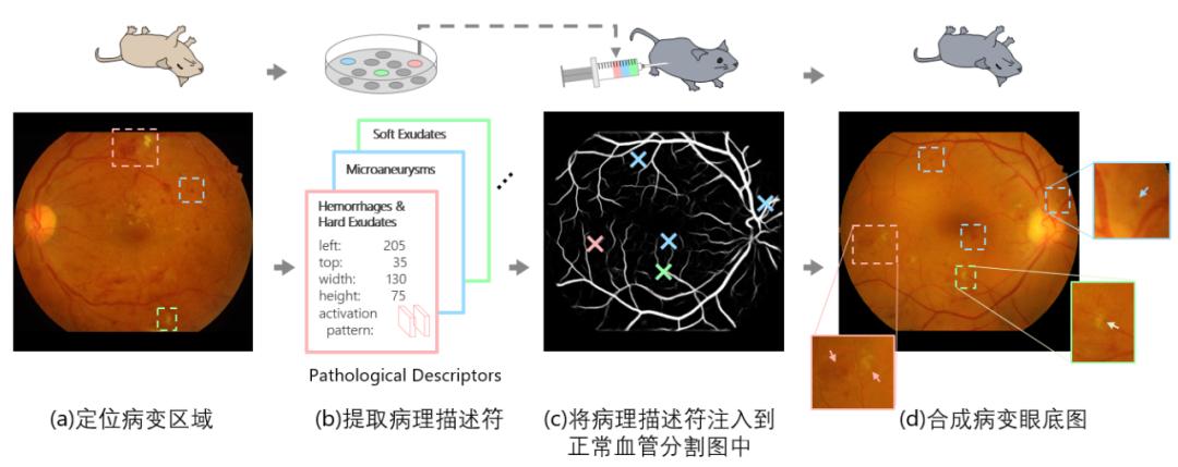 开源代码：轻量级医学可解释性＋真实病灶数据增强插图